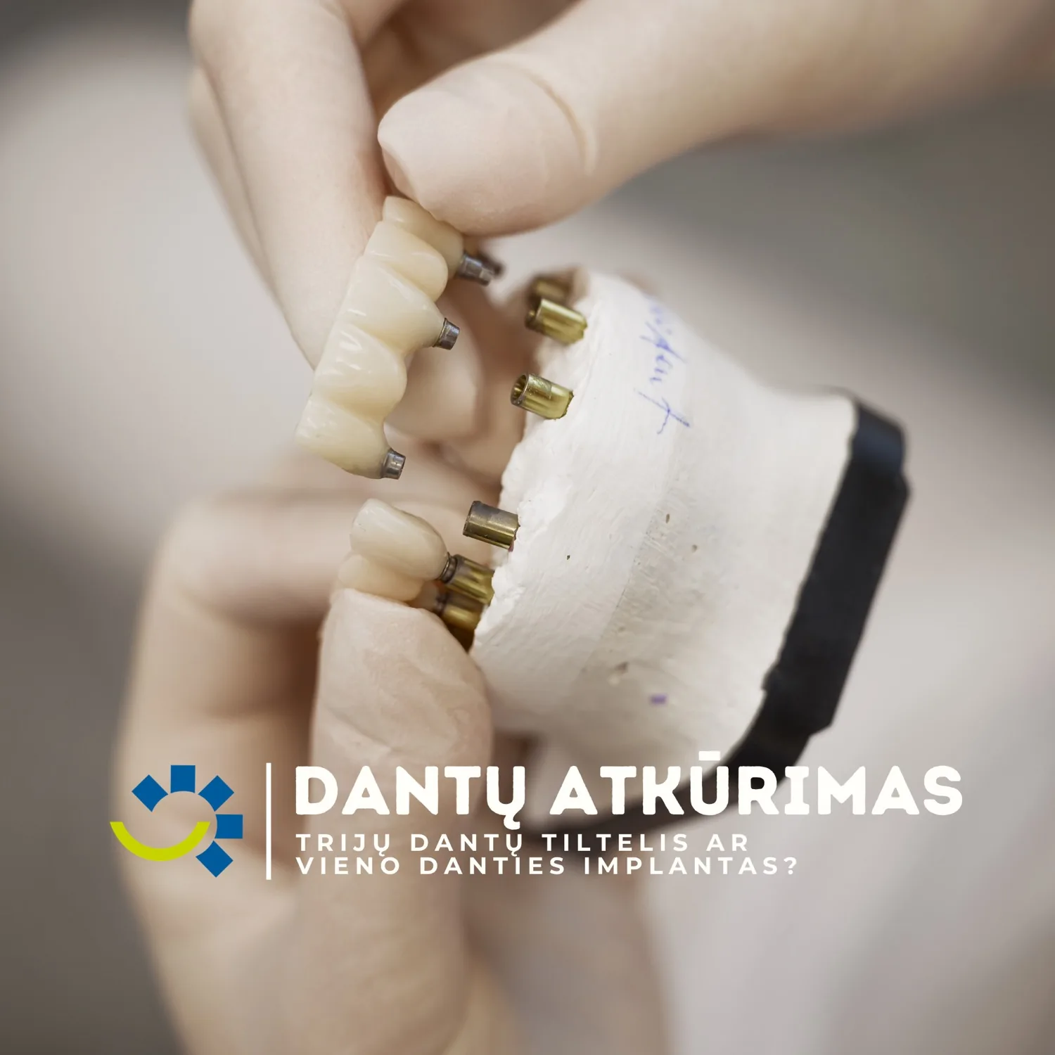 Kauno ortodontijos centras – Ortodontija · Sveikatos paslaugos